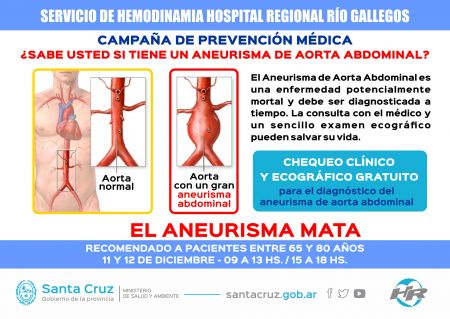 Se concretará campaña gratuita de detección de Aneurisma de Aorta Abdominal